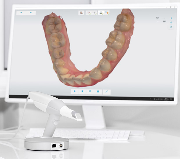 Miami Lakes 3D Cone Beam and 3D Dental Scans