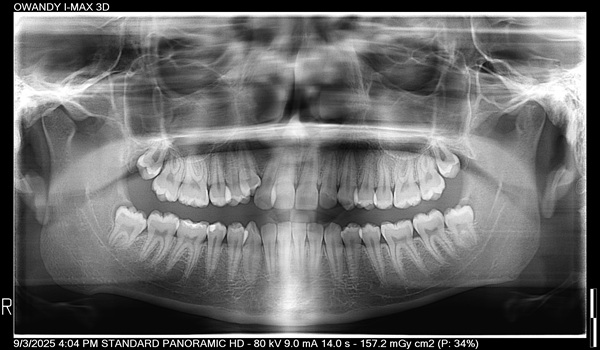 Dental-Surgery