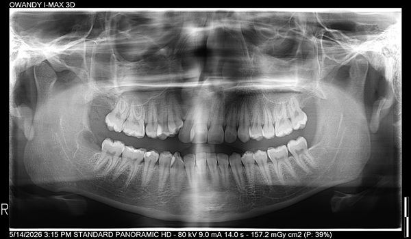 Dental-Surgery