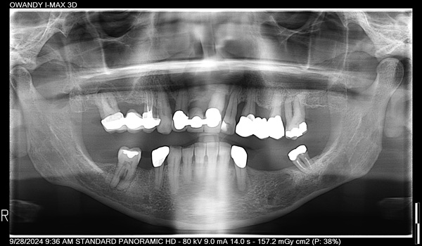 Dental-Surgery