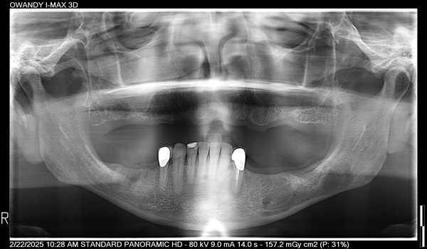 Dental-Surgery