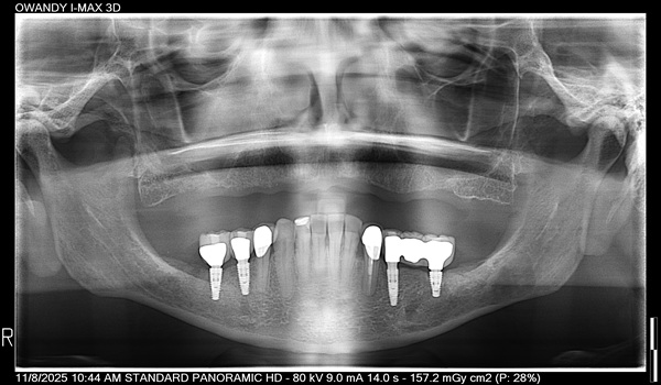 Dental-Surgery