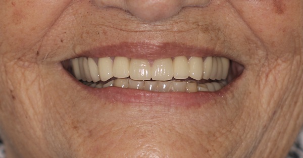 Restorative-Dentistry