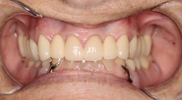 Restorative-Dentistry