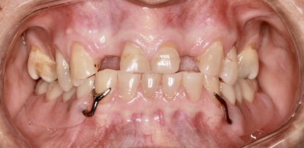 Restorative-Dentistry