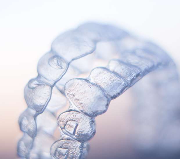 Miami Lakes ClearCorrect Braces