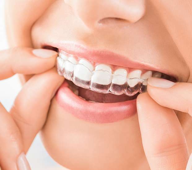 Miami Lakes Does Invisalign Really Work