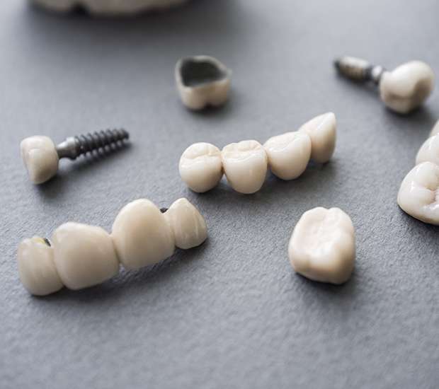 Miami Lakes The Difference Between Dental Implants and Mini Dental Implants