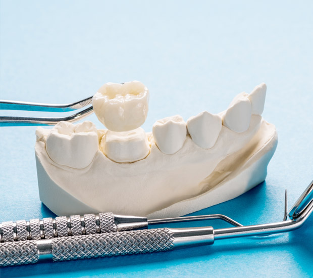 Miami Lakes Prosthodontist